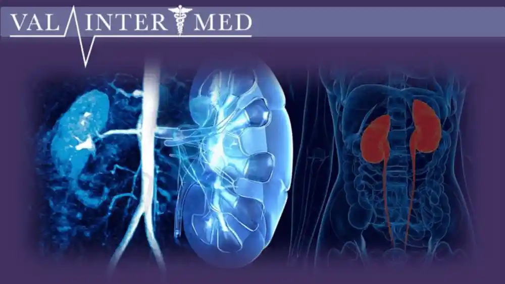 Tratamiento de las infecciones urinarias en la mujer. Cistitis.
