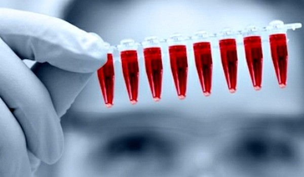 Blood test in Valencia and throughout Spain