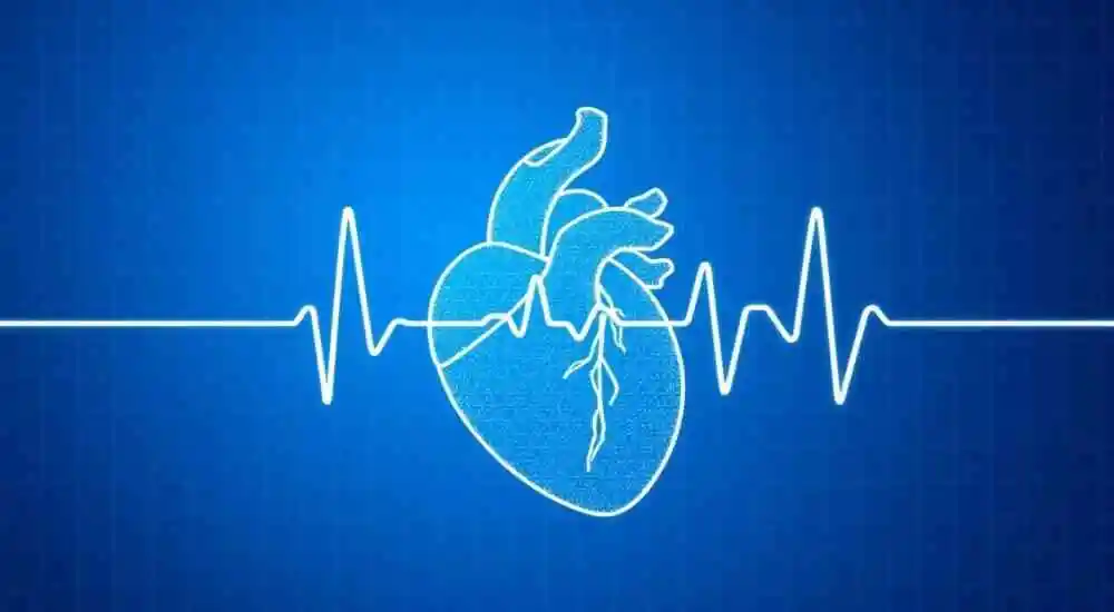fibrilación ventricular
