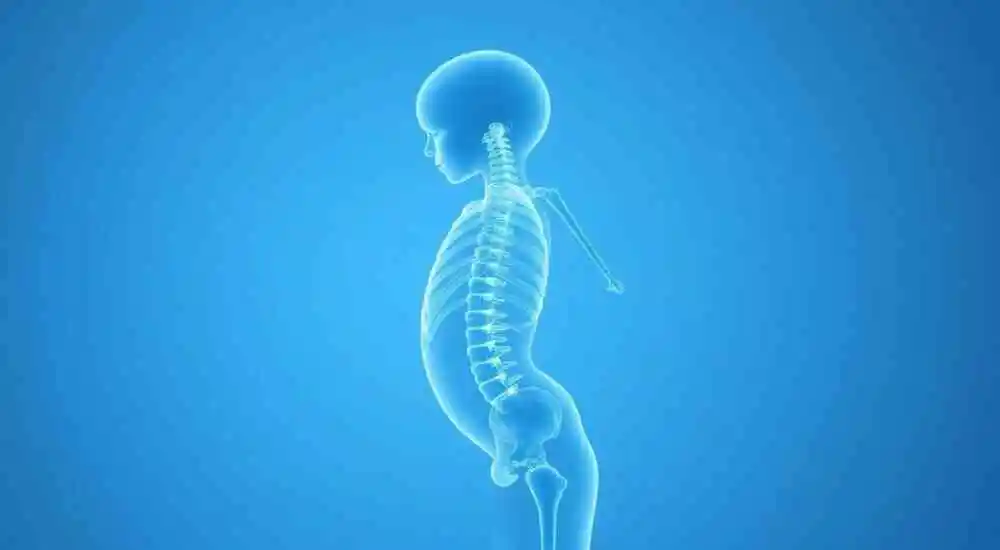 Atrofia muscular espinal (AME)