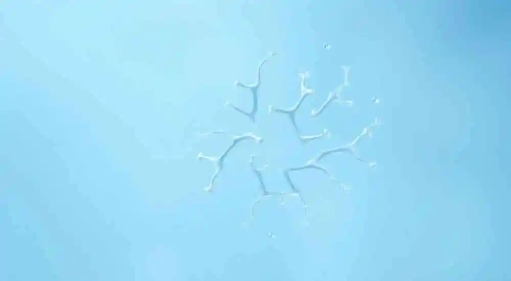 Vaginal yeast infection