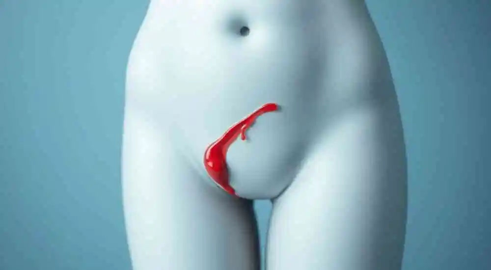 Vaginal bleeding between periods