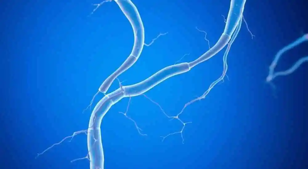 Venous insufficiency
