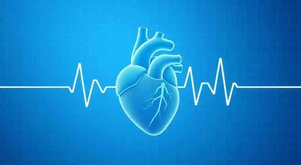 Ventricular tachycardia