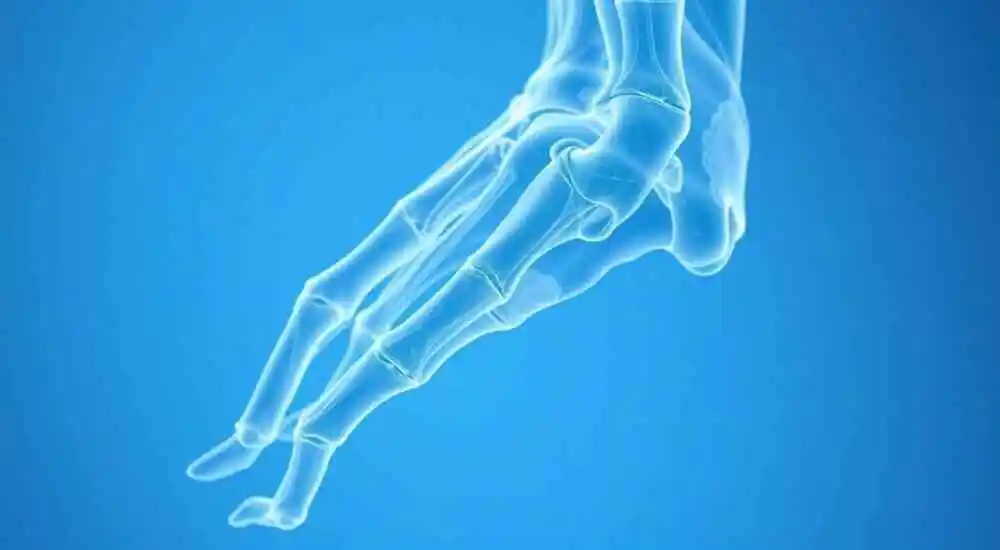 Rizartrosis