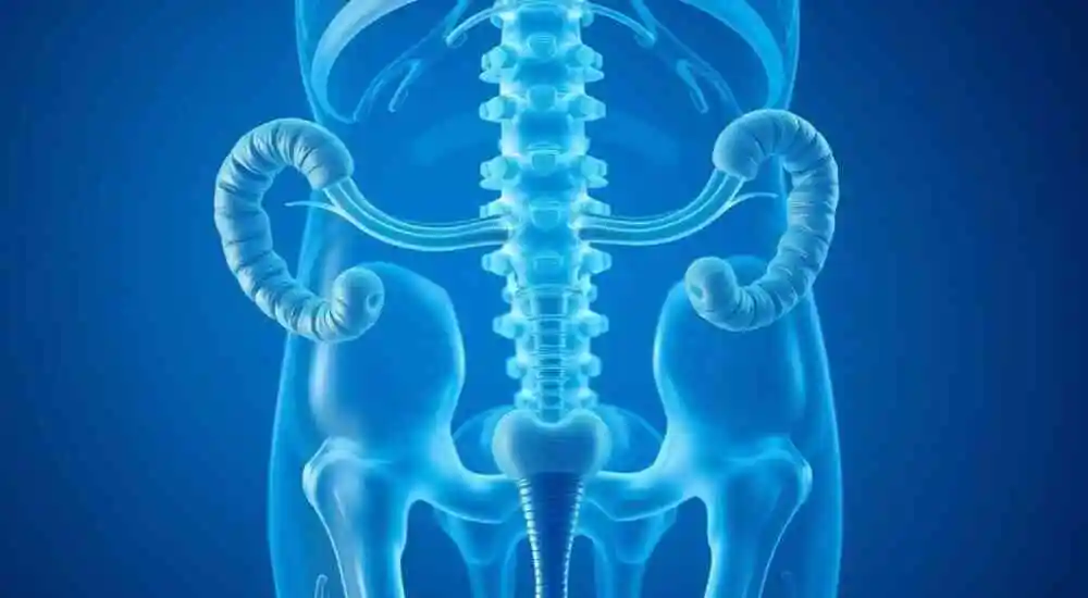 carcinosarcoma de ovario