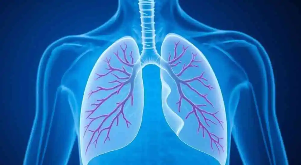 Fístula arteriovenosa pulmonar