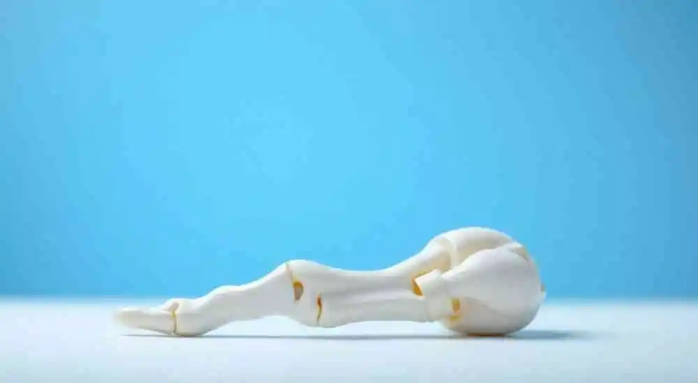 Osteomielitis en niños