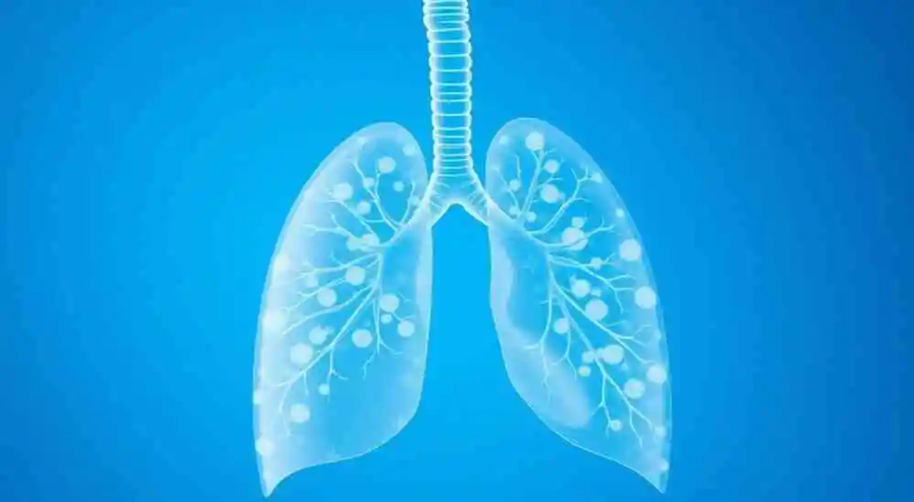 Edema pulmonar