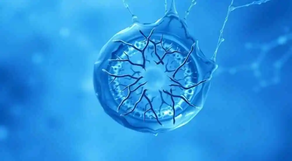 Acidosis tubular renal