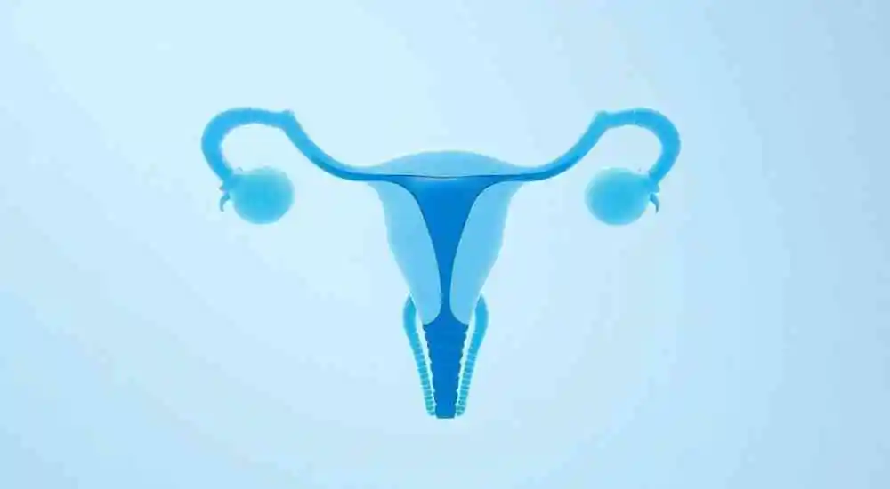 cáncer de ovario