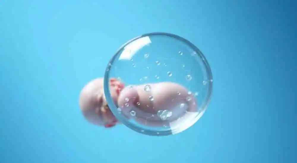Ovarian cyst in newborns