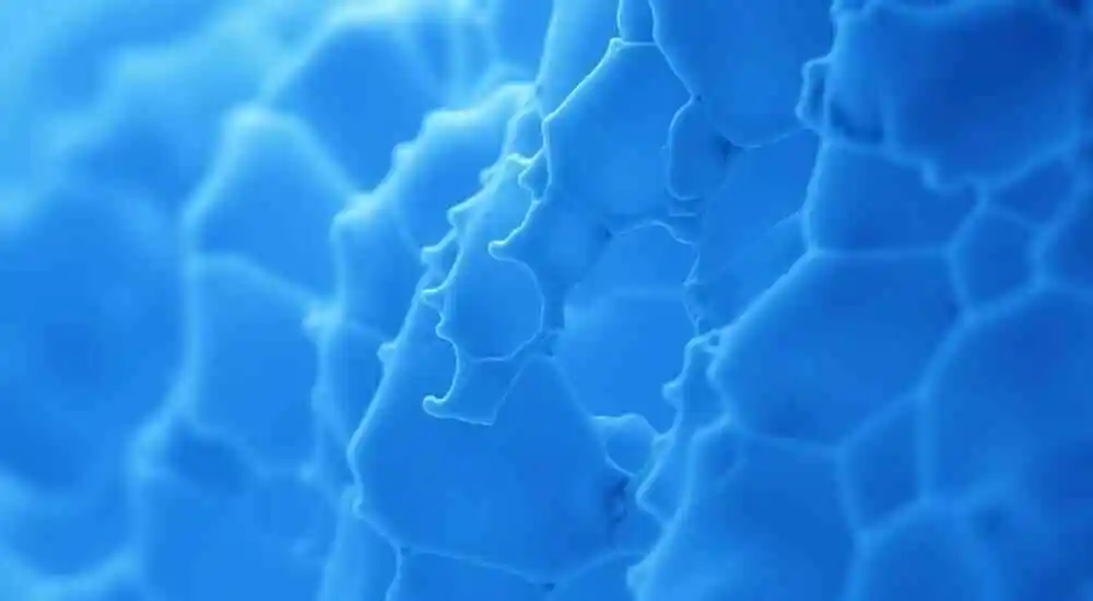 Liposarcoma mixoide