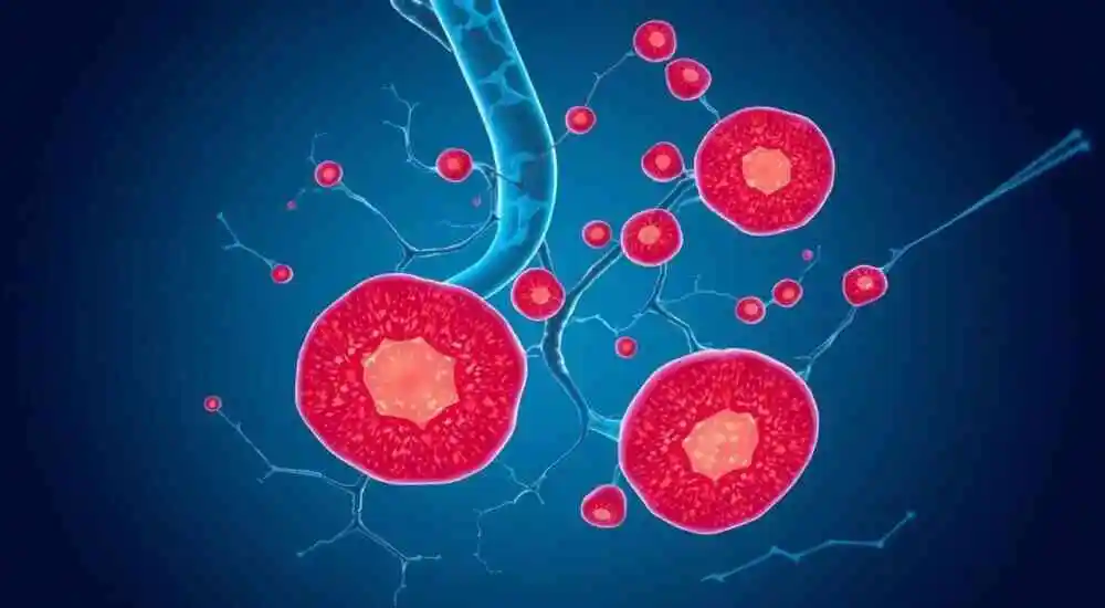 Foliculitis