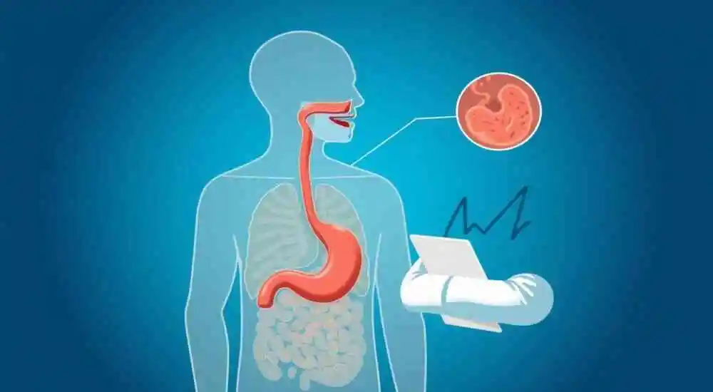 Гастроэзофагеальная рефлюксная болезнь (ГЭРБ)
