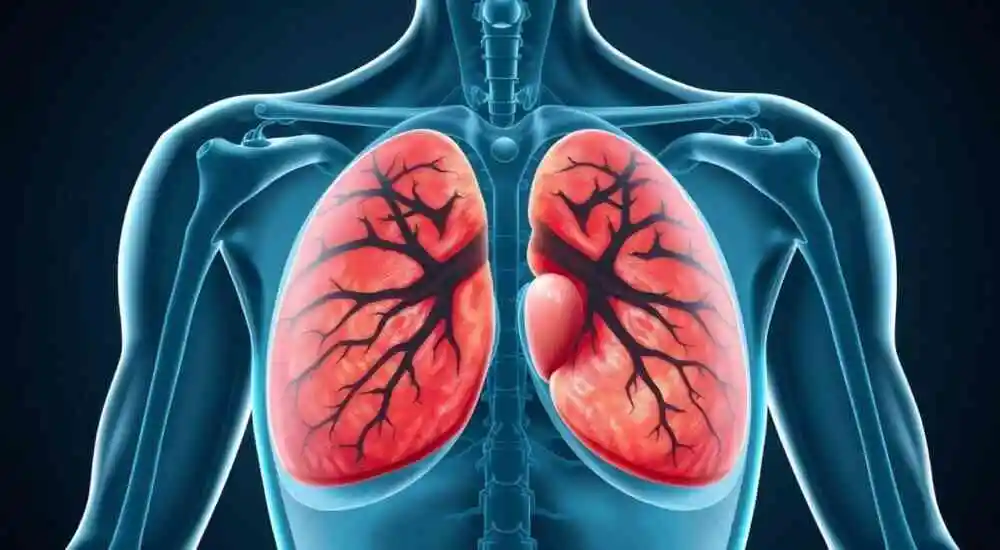 Giant hamartoma of the mammary gland