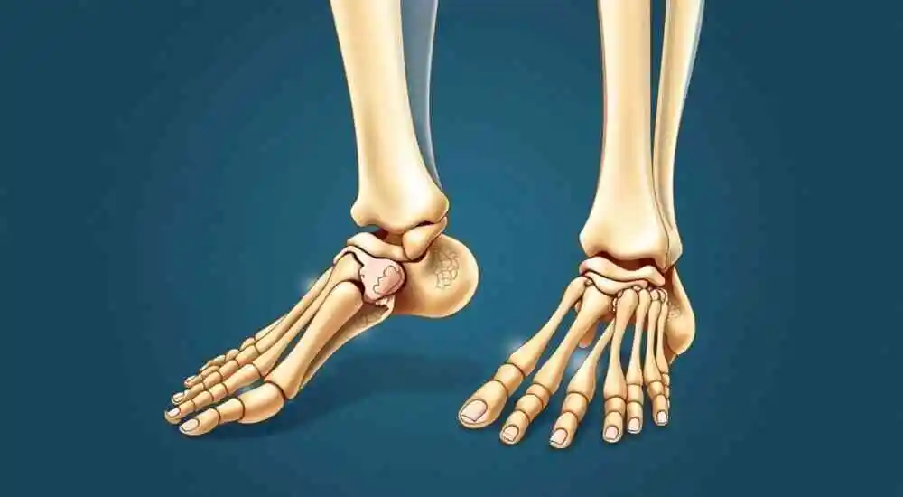 Tibial hypoplasia with polydactyly