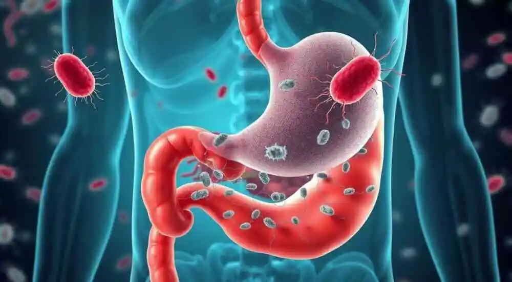 Инфекция Helicobacter Pylori