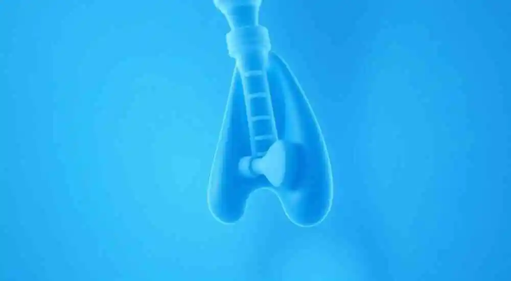Laringomalacia