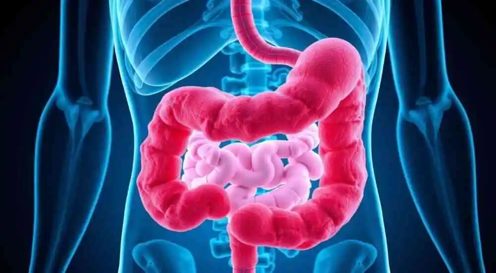 Leiomioma intestinal