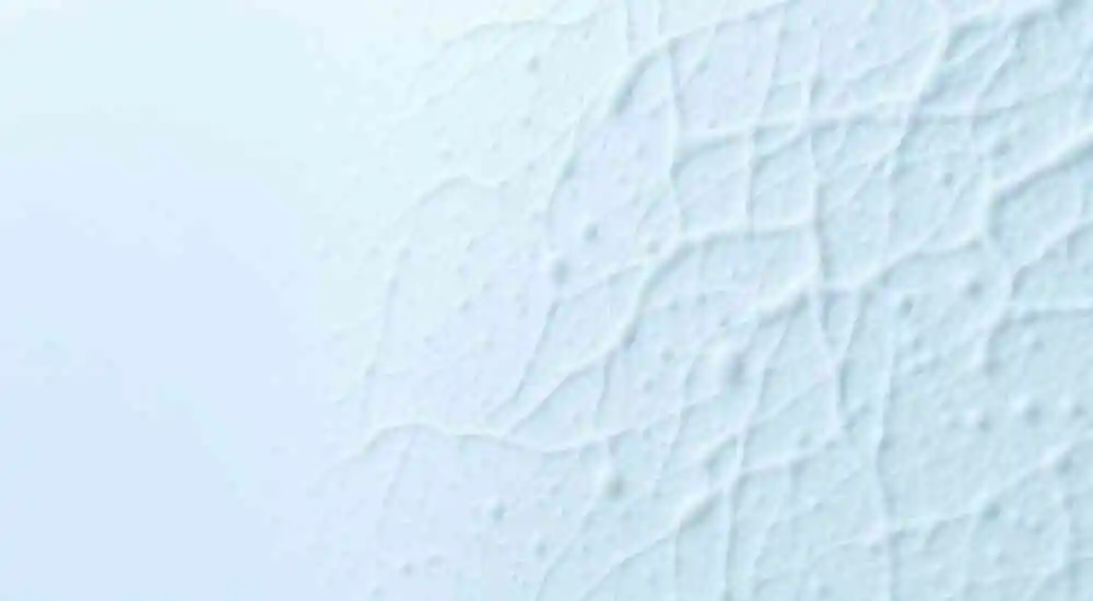 Esclerodermia localizada