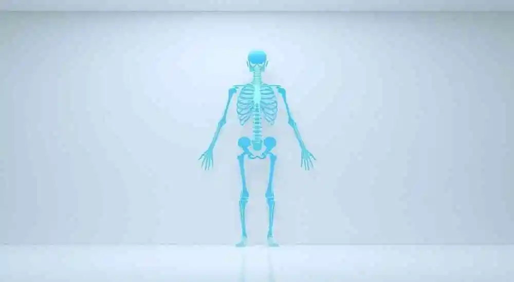 Lordosis