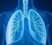 Metastases in the lungs