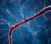 Hereditary sensory and autonomic neuropathy type 2
