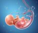 Fetal edema