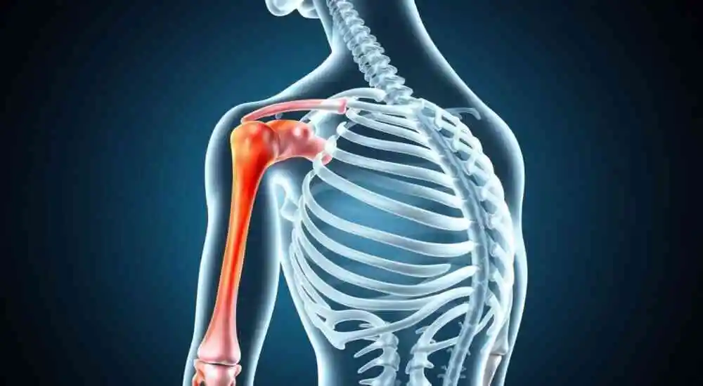 Distrofia muscular facioescapulohumeral (FSHD)
