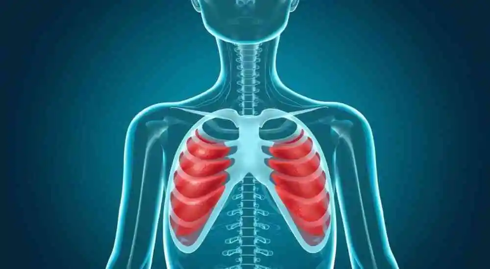 Familial multiple lipomatosis