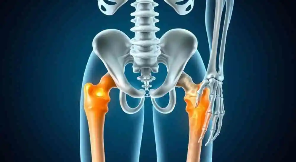 Fryns syndrome