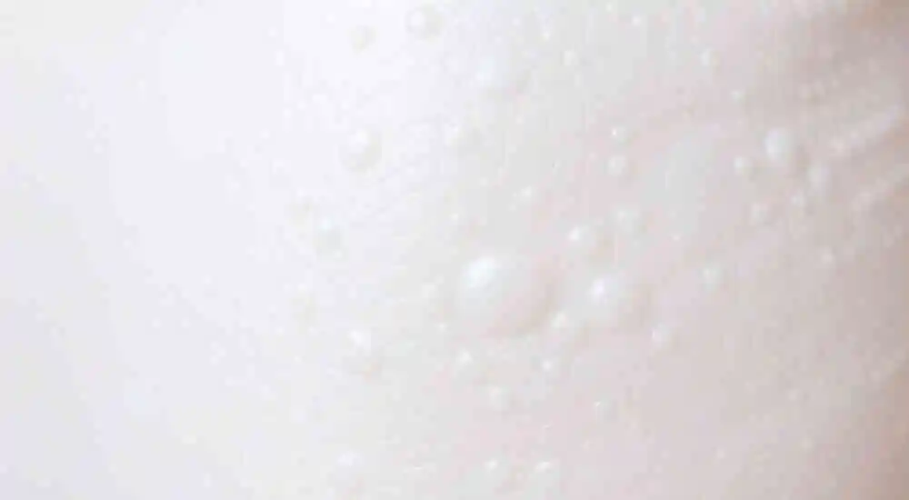 Epidermólisis ampollosa de unión