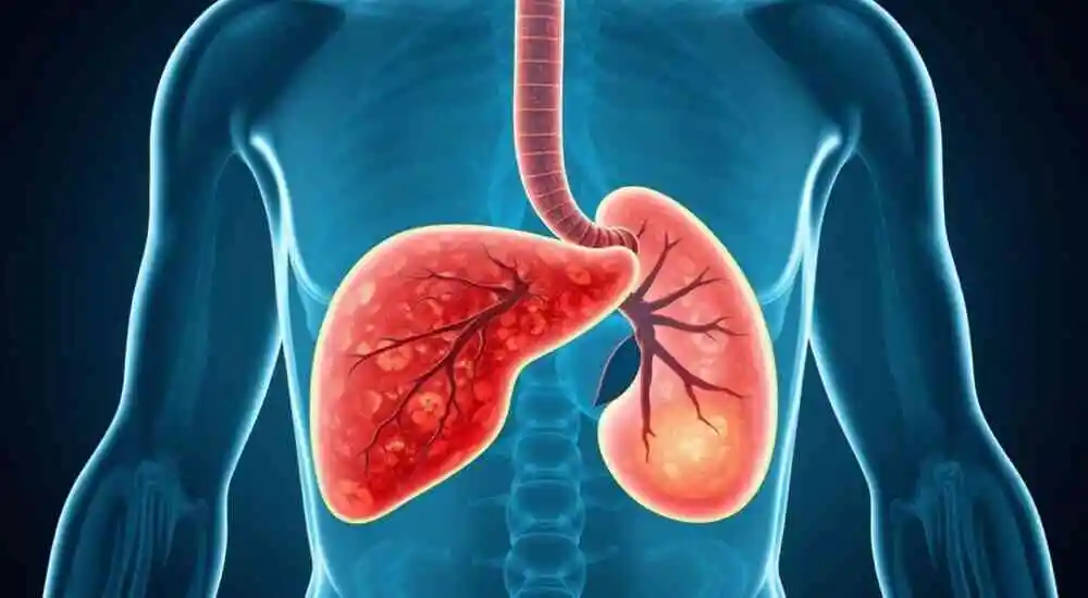 Ulcers of the female genital organs