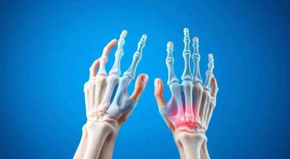 Artritis idiopática juvenil (AIJ)