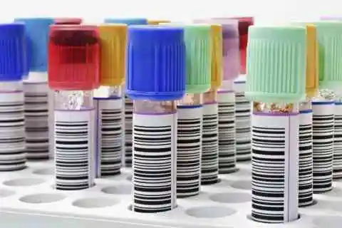 Tratamiento de las infecciones urinarias en la mujer. Cistitis.